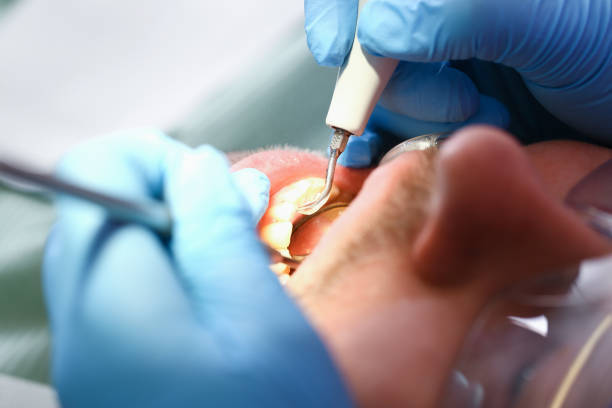 Best Urgent Dental Care for Toothaches in Burnet, TX