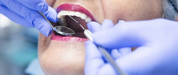 Best Emergency Root Canal Therapy in Burnet, TX